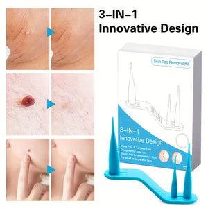 3 IN 1 Skin Tag Remover Wart Removal Mole Kit Tools, Skin Tag Removal Kit With Fast-Acting And Effectively Easy To Use At Home