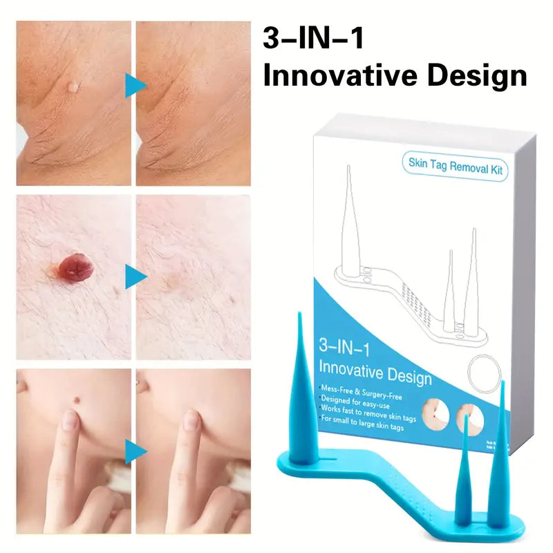 3 IN 1 Skin Tag Remover Wart Removal Mole Kit Tools, Skin Tag Removal Kit With Fast-Acting And Effectively Easy To Use At Home