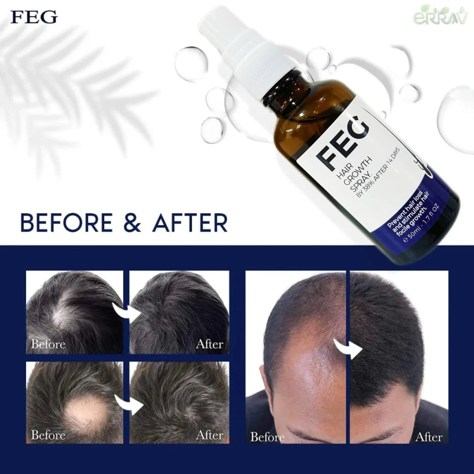 FEGPLUS Rosemary Beard & Hair Growth Serum (50ml), Rosemary Extract Serum Hair Spray, Rosemary Oil for Hair Growth Booster, Minoxidil Hair Fall Control, Stop Hair Loss Treatment & Thicker Hair